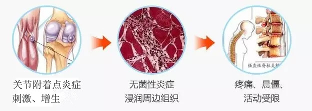 无菌性炎症增生增厚.jpg